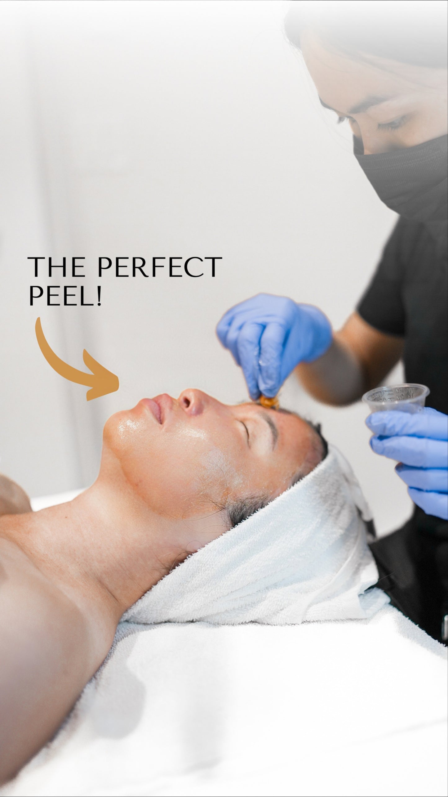 Perfect Derma Peel