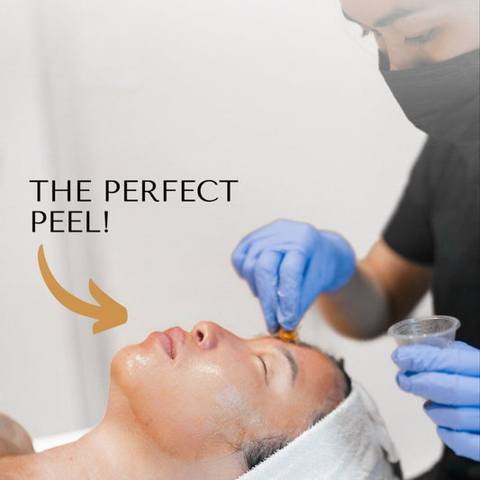 Perfect Derma Peel